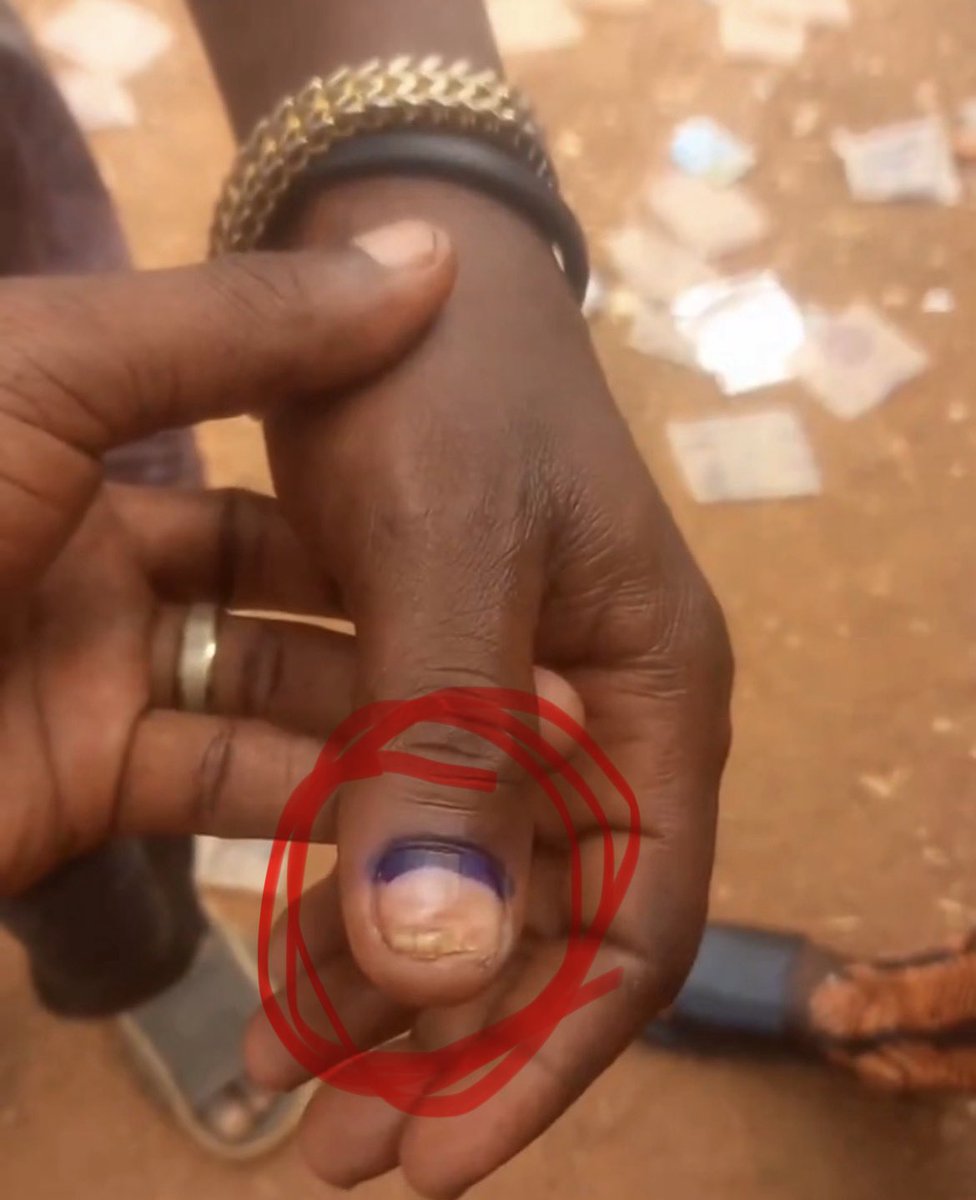 You are suffering from Malnutrition. You still went ahead to vote APC.

lol 😂