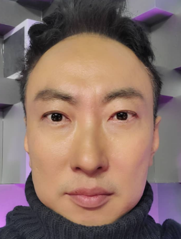 남자인데 관리 뭐부터 시작해요..?
(내가 하려고 알아봄)

1. 운동, 깔끔한 옷차림, 헤어 스타일 변화, 기본적인 세안, 보습, 선크림 등 홈케어 시작.

2. 뭔가 이제 해보고 싶은데 뭐부터 해야 가성비가 좋지..?
2-1 레이저 제모(수염 자국 제거, 모낭염 방지 됌)
2-2 여드름 및 자국 관리 (여드름