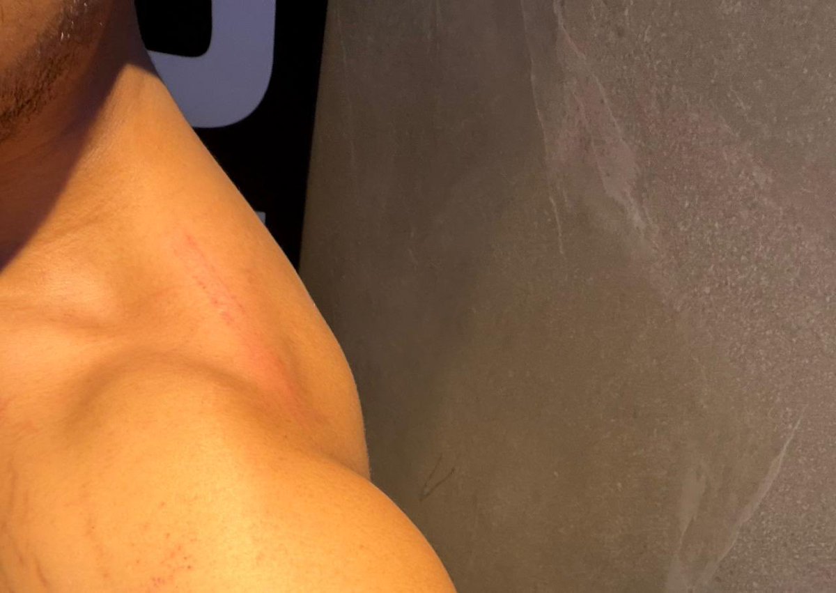 kokgitugy's tweet image. Oleh-oleh tiap beres leg day adalah merah-merah gitu🥵