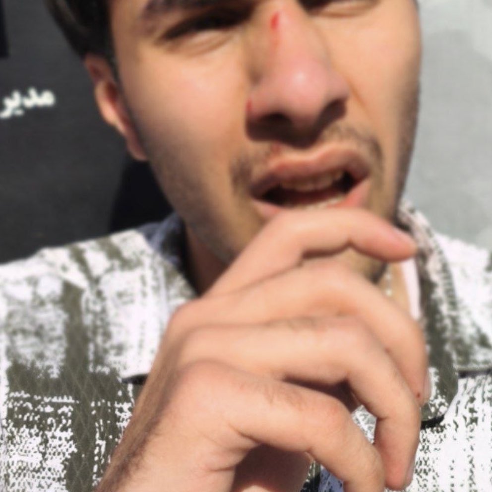 همسر میون پنبه🐰 tweet media