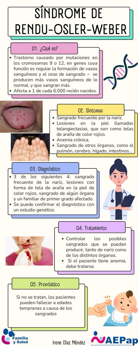 familiaysalud's tweet photo. Síndrome de Rendu-Osler-Weber  
Es un trastorno causado por mutaciones en cromosomas 9 o 12, en unos genes que regulan la formación de vasos sanguíneos y el cese de sangrado --Síntomas  
-Diagnóstico  
-Tratamiento 
-Pronóstico  
*INFOGRAFÍA
https://t.co/LNLDikw91m https://t.co/9YNe5rNxZF