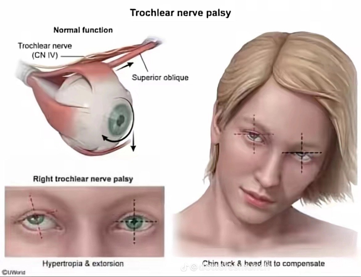 Suntasuelta🪾 tweet media