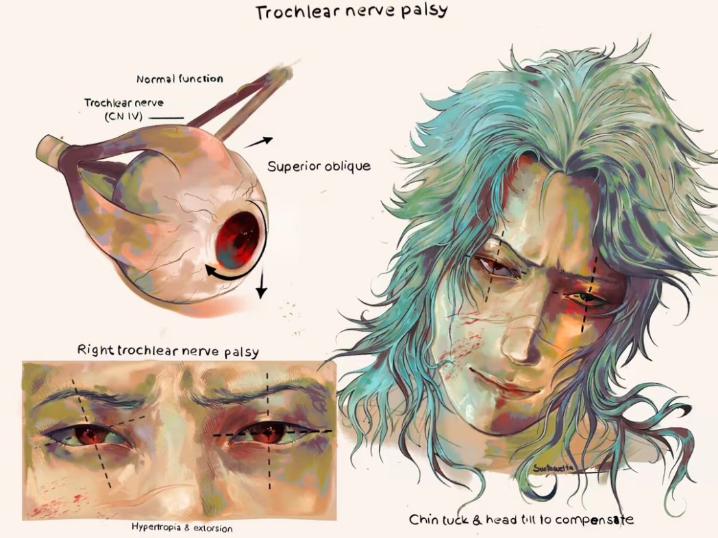 Suntasuelta🪾 tweet media