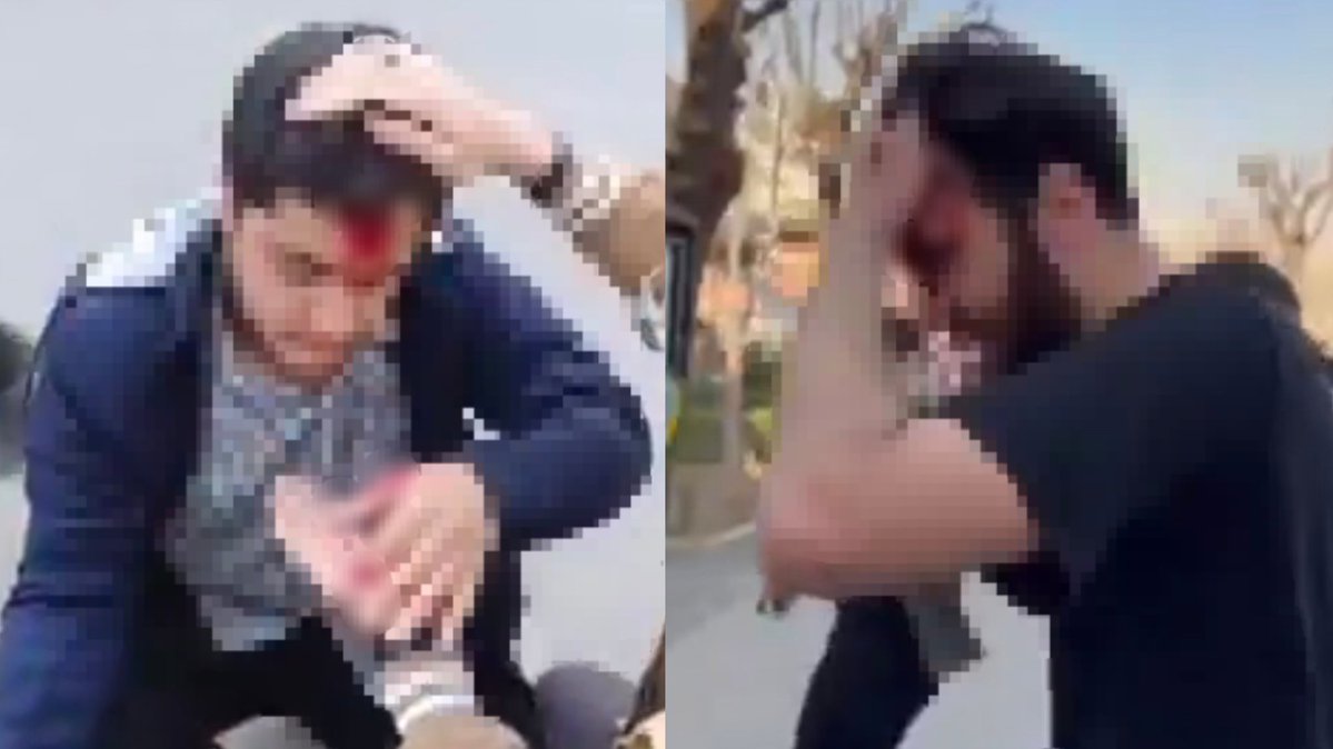 asena51220's tweet image. این یک سناریوی نمایشی برای مظلوم نمایی
جهانی ست..فریب نخورید ...

وحشی شما هستید که با توپ و تفنگ به جان مردم افتادید و قتل عام کردید.
#ننگ_بر_سه_فاسد_ملا_چپی_مجاهد