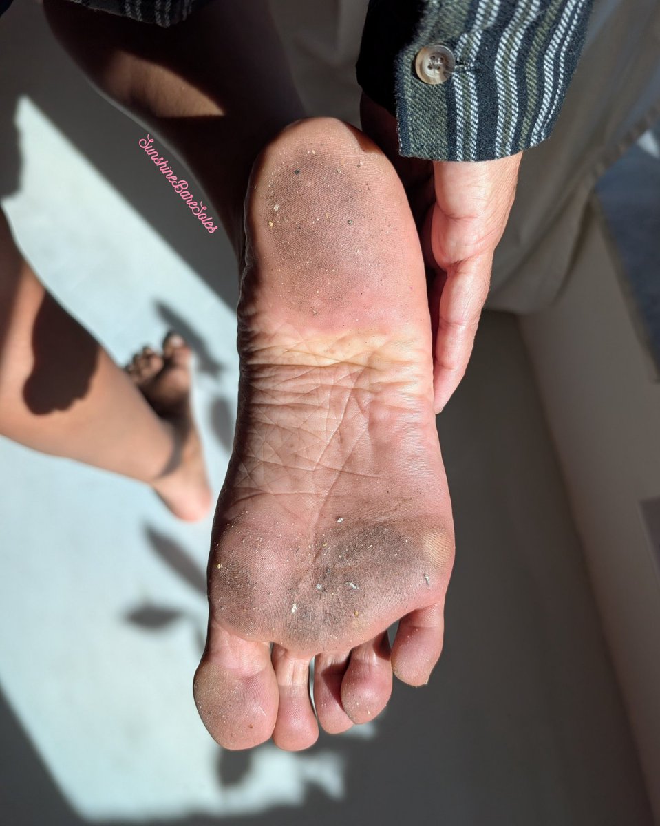 SunshineBareSoles tweet media