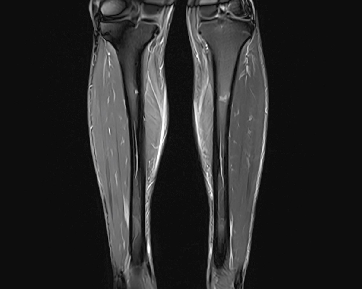 twentysick_'s tweet image. RT @karirfess: taraweh + imamnya hafiz quran = leg day🙃