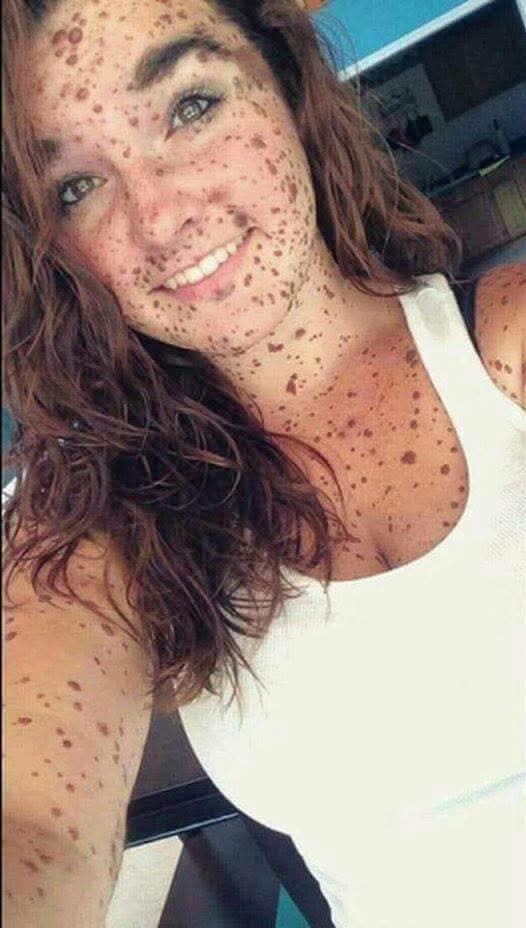 Maryamart011's tweet image. She is suffering from skin cancer♋
Her husband left her 
He says she is ugly.
Show the power of prayers 
Can she get 9999 likes to prove she is not ugly 
Dont scroll without typing Amen