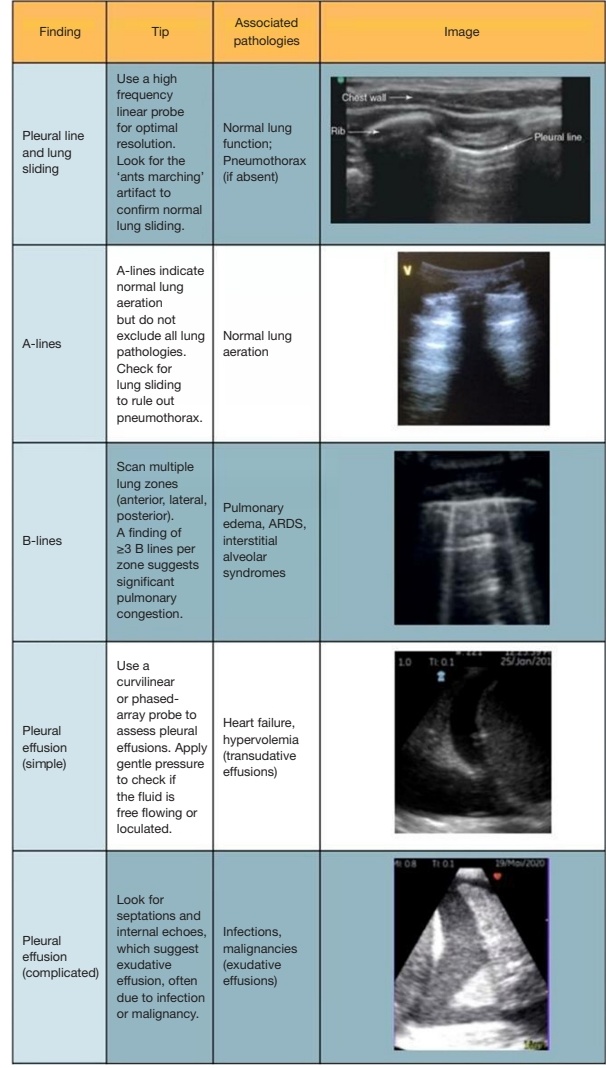CantillMauricio's tweet image. The role of thoracic ultrasound in fluid management in critical care: a narrative review. #POCUS #PedsICU
qxmd.com/r/41660483 #ReadByQxMD
