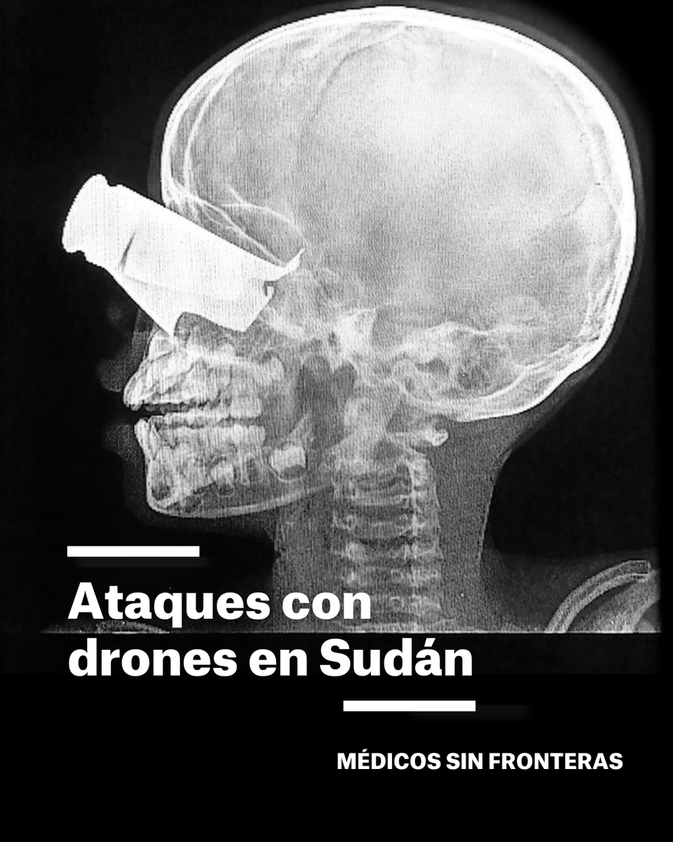 Médicos Sin Fronteras tweet media