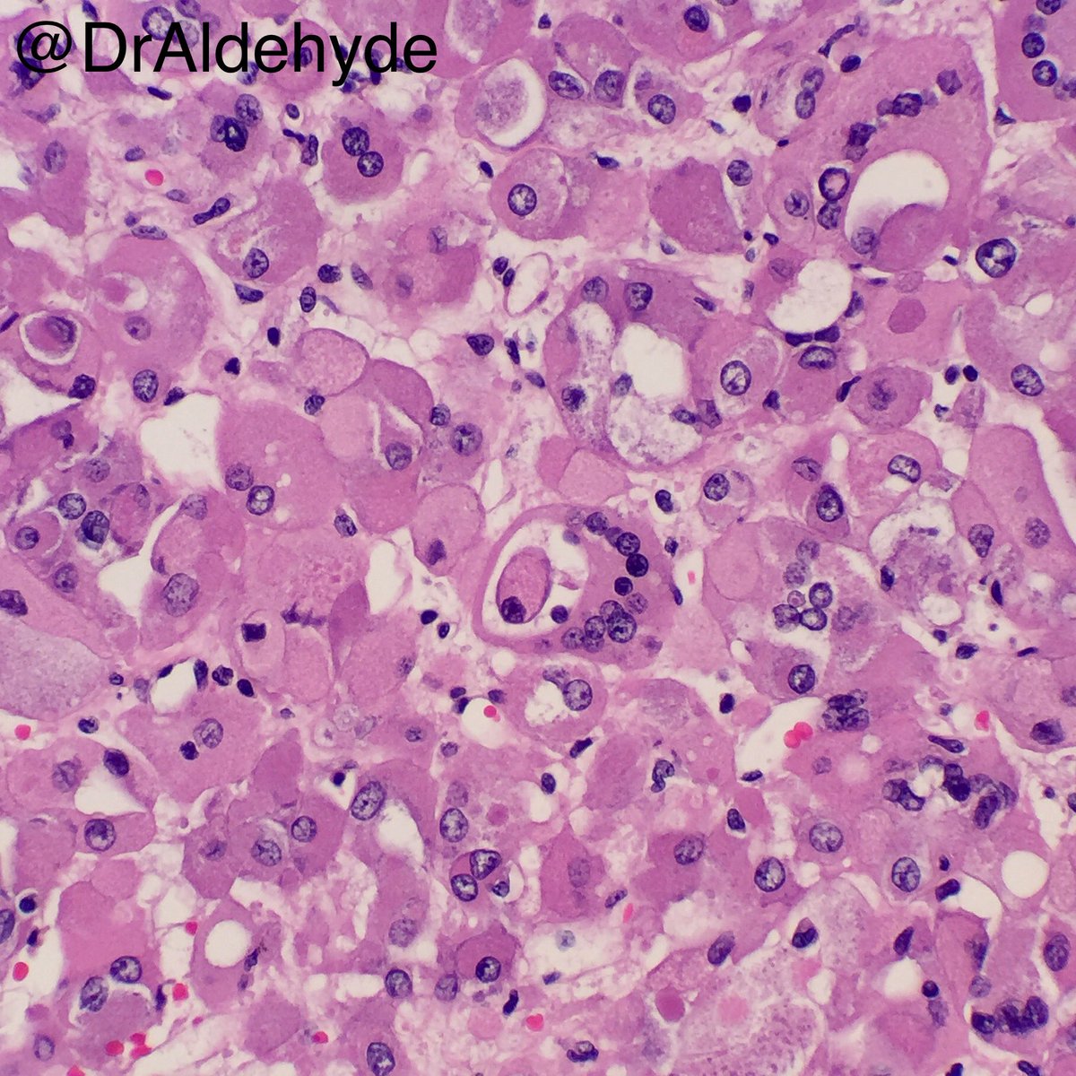 Woo Cheal Cho, MD tweet media