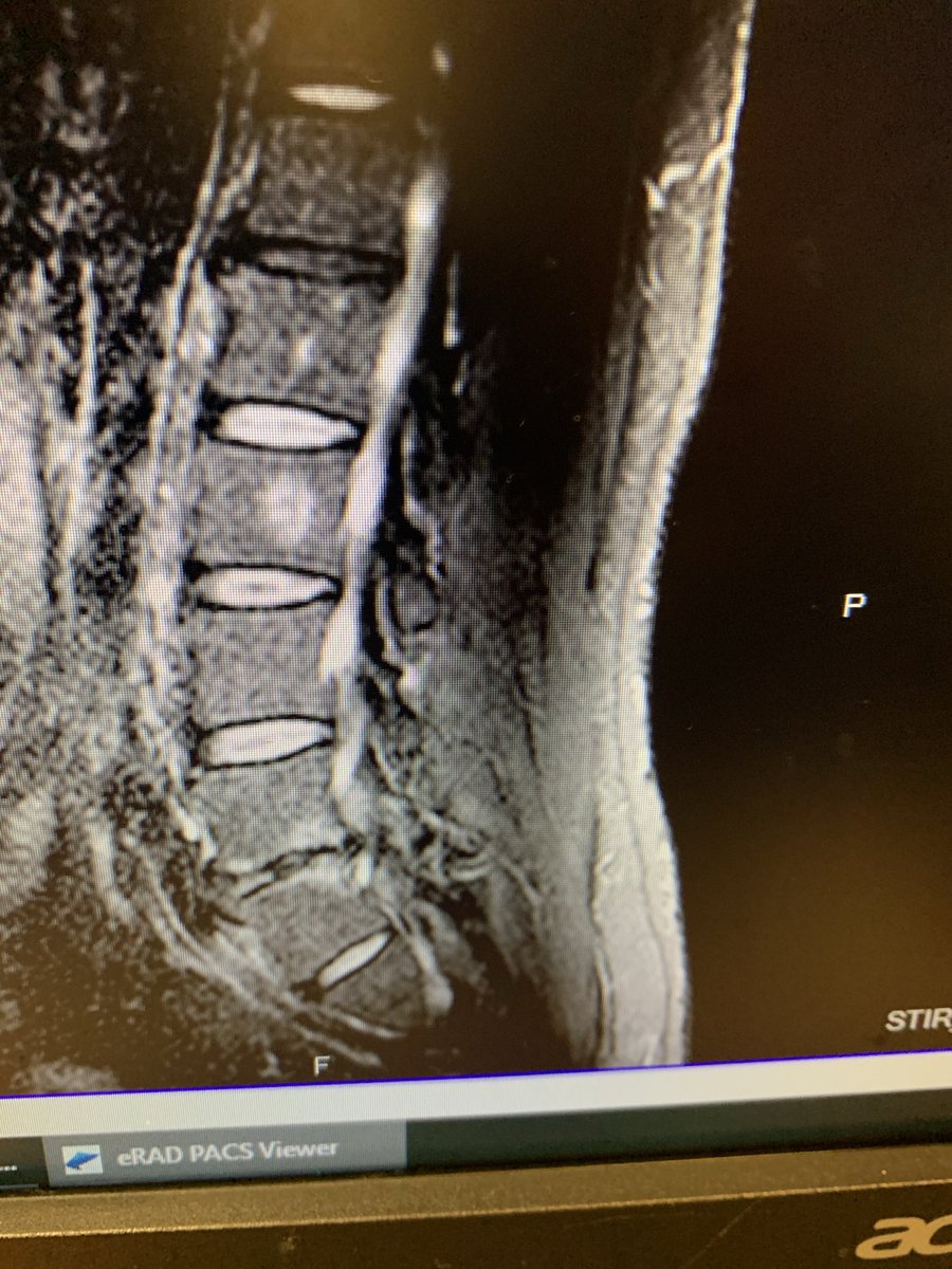 Jay Glazer tweet media