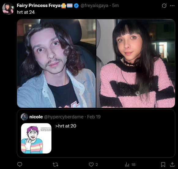 XelDungeon's tweet photo. @hypercyberdame It took me 3 minutes to find people to prove you wrong and there's more beautiful people on the RTs. It takes no effort to find people who reflect their gorgeous personality on the outside as well.

Maybe find something better to do with you time, because I have a life outside X. https://t.co/CC1803hwTs