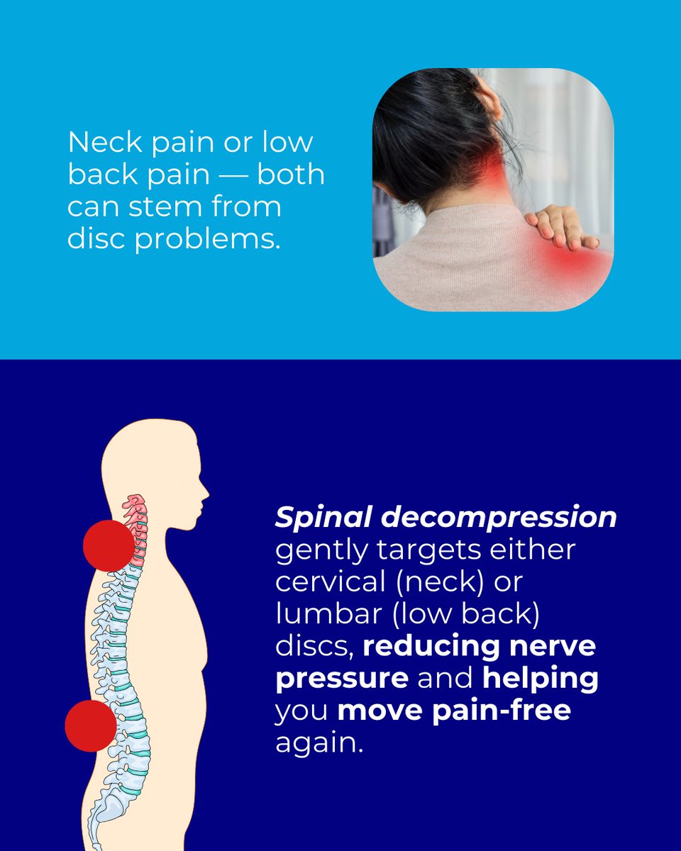 JDchiro's tweet image. Disc bulge or herniation, both can press on nerves and cause serious pain.

The good news? Spinal decompression helps relieve that pressure naturally.
👉 Don’t wait for it to get worse, book a consultation today.

#BackPainRelief #SpinalDecompression #HerniatedDisc #SciaticaHelp