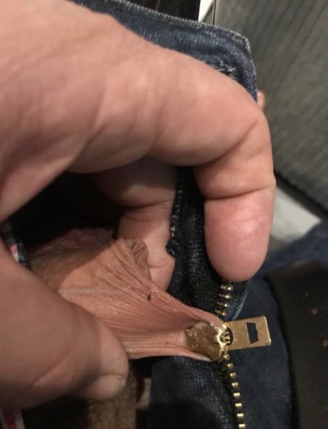 There's nothing as painful as this, not even childbirth. 😭

Prove me wrong