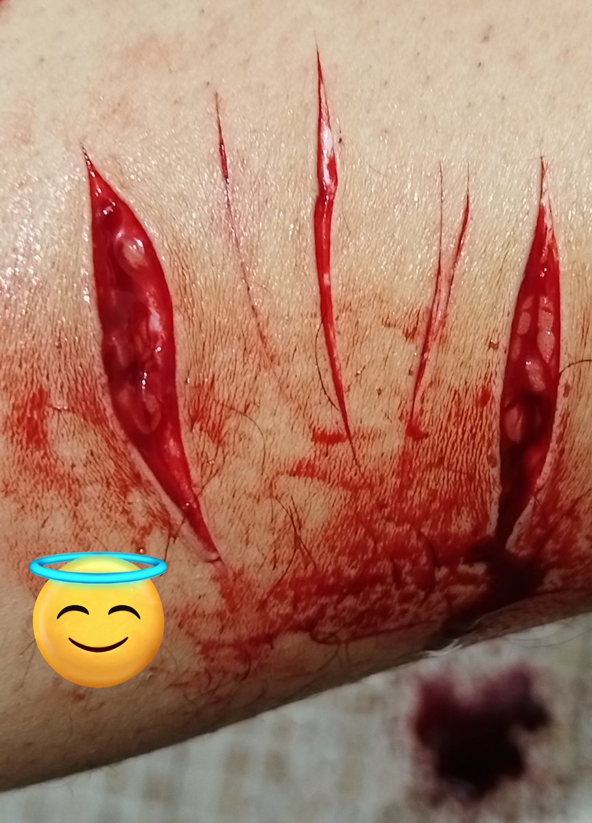 Blaze 🕷️ tweet media