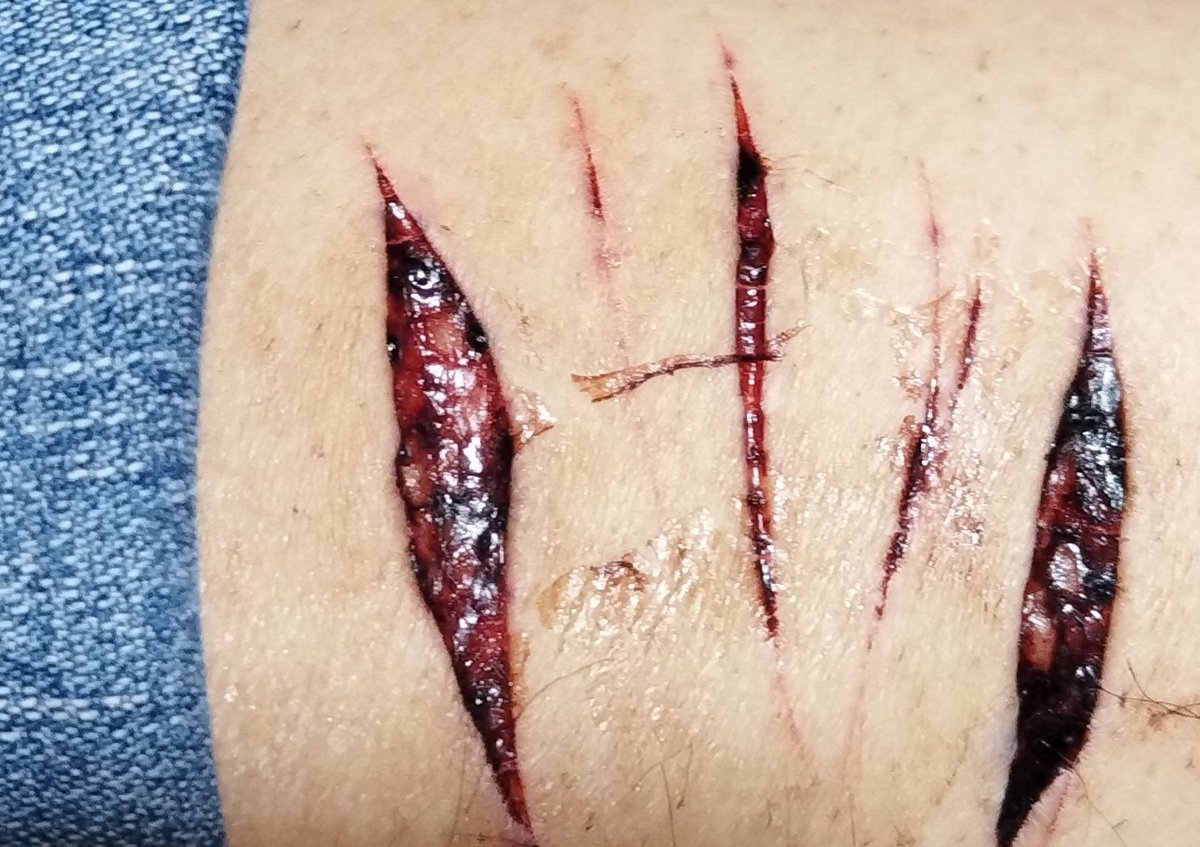 Blaze 🕷️ tweet media