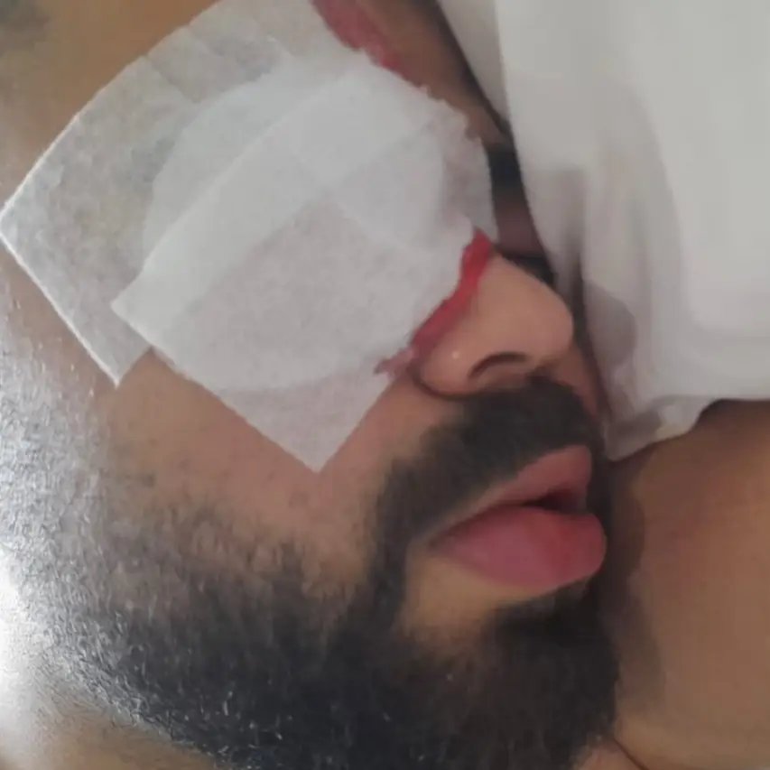 Gaziantep’te Koza Polyester Fabrikası’nda koruyucu gözlük verilmediği için kopan metal parçası bir işçinin gözüne isabet etti; işçi %80 görme kaybı yaşadı.

İşçiye verilmeyen koruyucu ekipmanın maliyetinin 200 TL olduğu öğrenildi.

(Evrensel-Mesut Baylav)