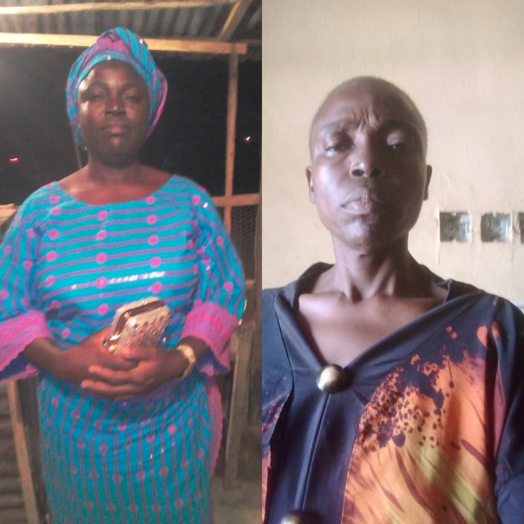 fifss__'s tweet image. Hello everyone 
Her name is Adeyinka Yemisi. She is a fashion designer. She has been battling with ovarian cancer since 2024 and it is not getting any better. She has been given a deadline to find the sum of 15M to undergo a second surgery. 
  Nothing is too small and anything