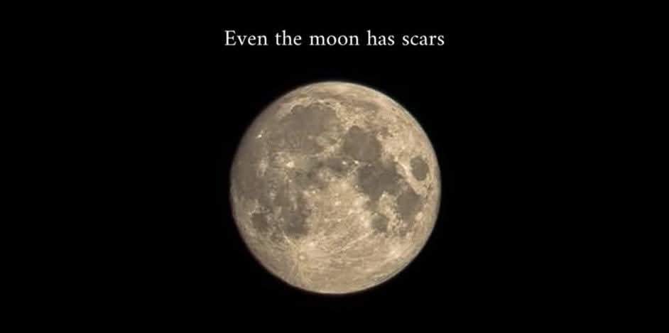 “even the moon has scars”