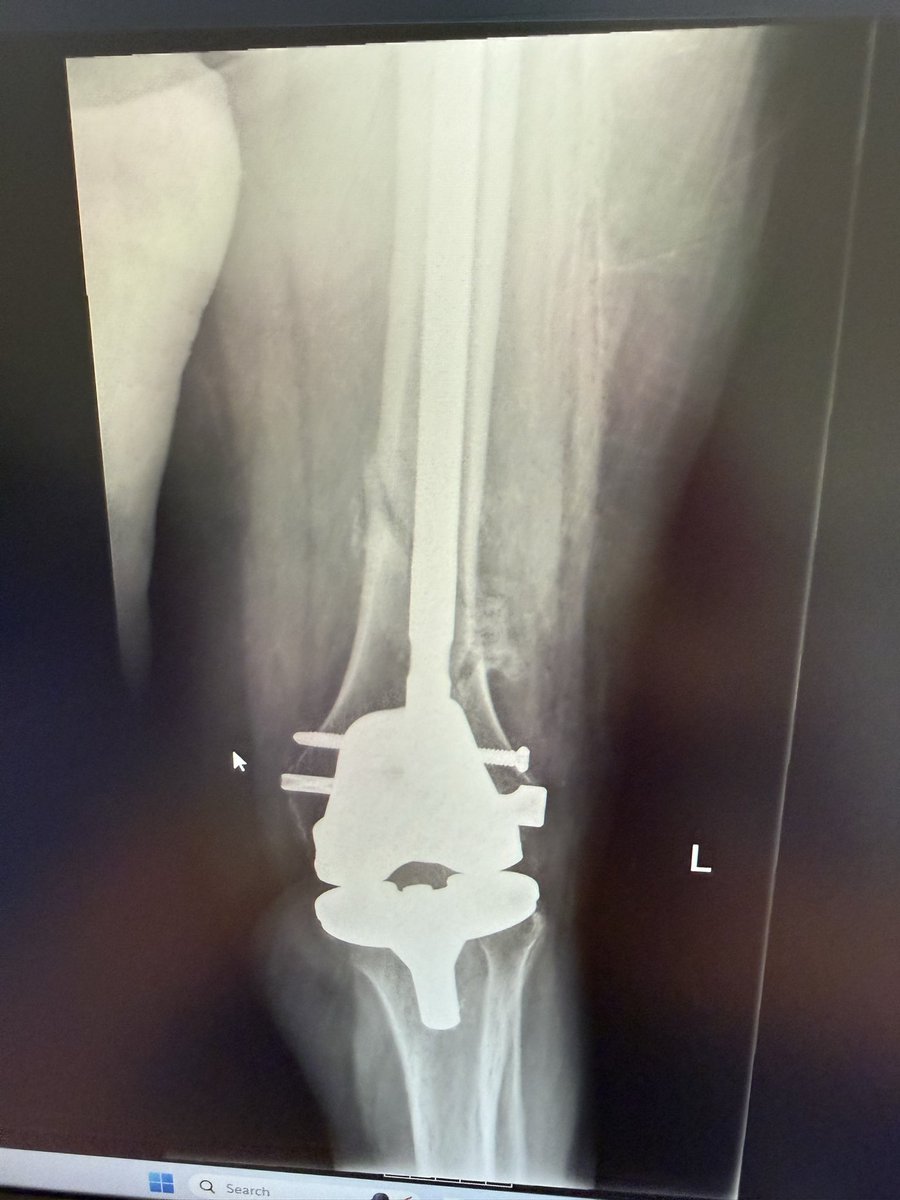 SP Orthopaedics tweet media