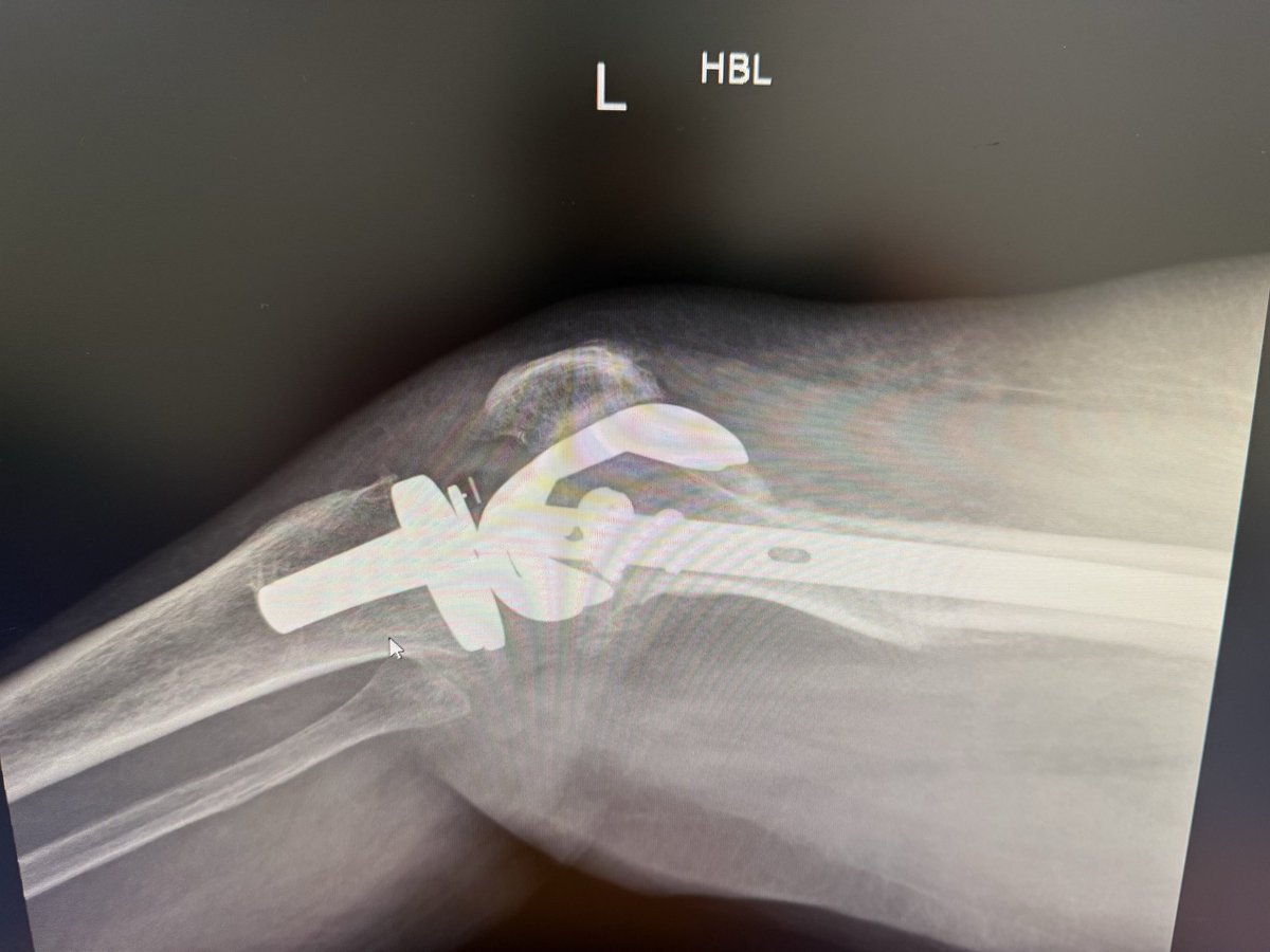 SP Orthopaedics tweet media