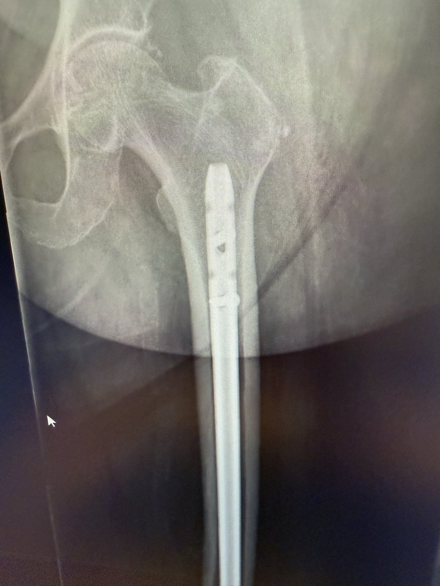 SP Orthopaedics tweet media