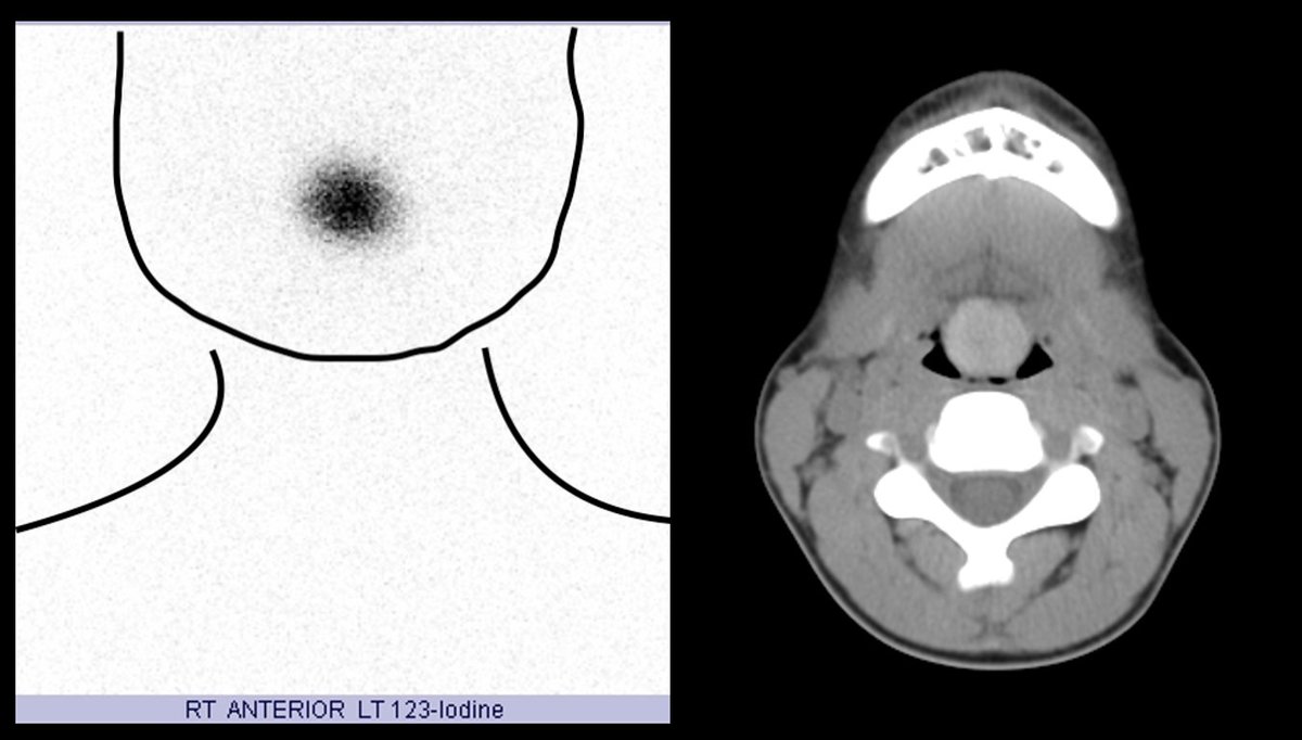 Nuclear MD tweet media
