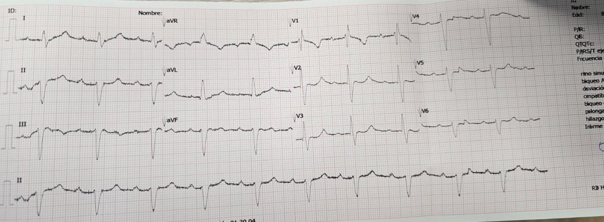 Sohrab Ayoubi tweet media