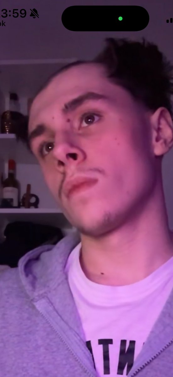 Kickstreamclipp's tweet image. Hs scammed me. 
Made me shave my head . 
Hs told yacob said drag me back into vc and he never did 
#hs #hstikkytokky #justiceforkai 
@HSTIKKYTOKKY4 @SamYaffe15 @__yacob__ pls