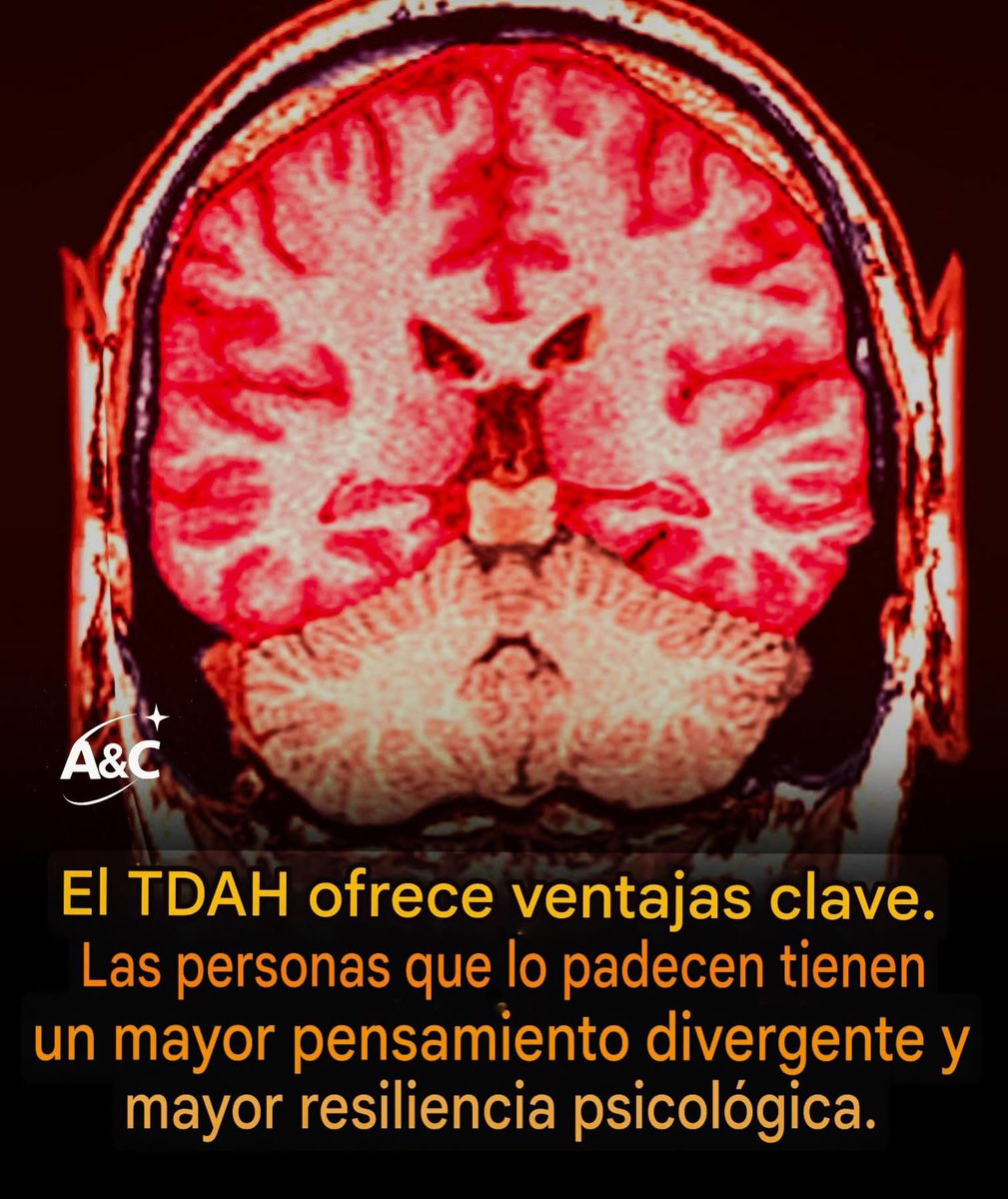 Una nueva investigación muestra que los rasgos del TDAH (Trastorno por Déficit de Atención e Hiperactividad) pueden ser motores inesperados detrás de la innovación avanzada y el logro creativo.

El TDAH es una condición del neurodesarrollo caracterizada por dificultades en la