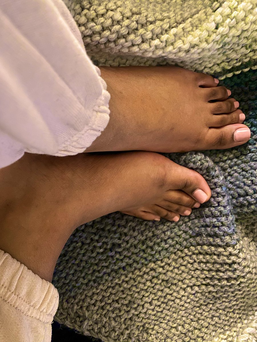 Nik8088's tweet photo. A week with this yummy pink pedicure.. my toes look like bubble gum.. 🖤I know my feet make your mouth water..💋

NSFW • OF • Fansly • Ebony • Foot Fetish https://t.co/hDWLFX6irS
