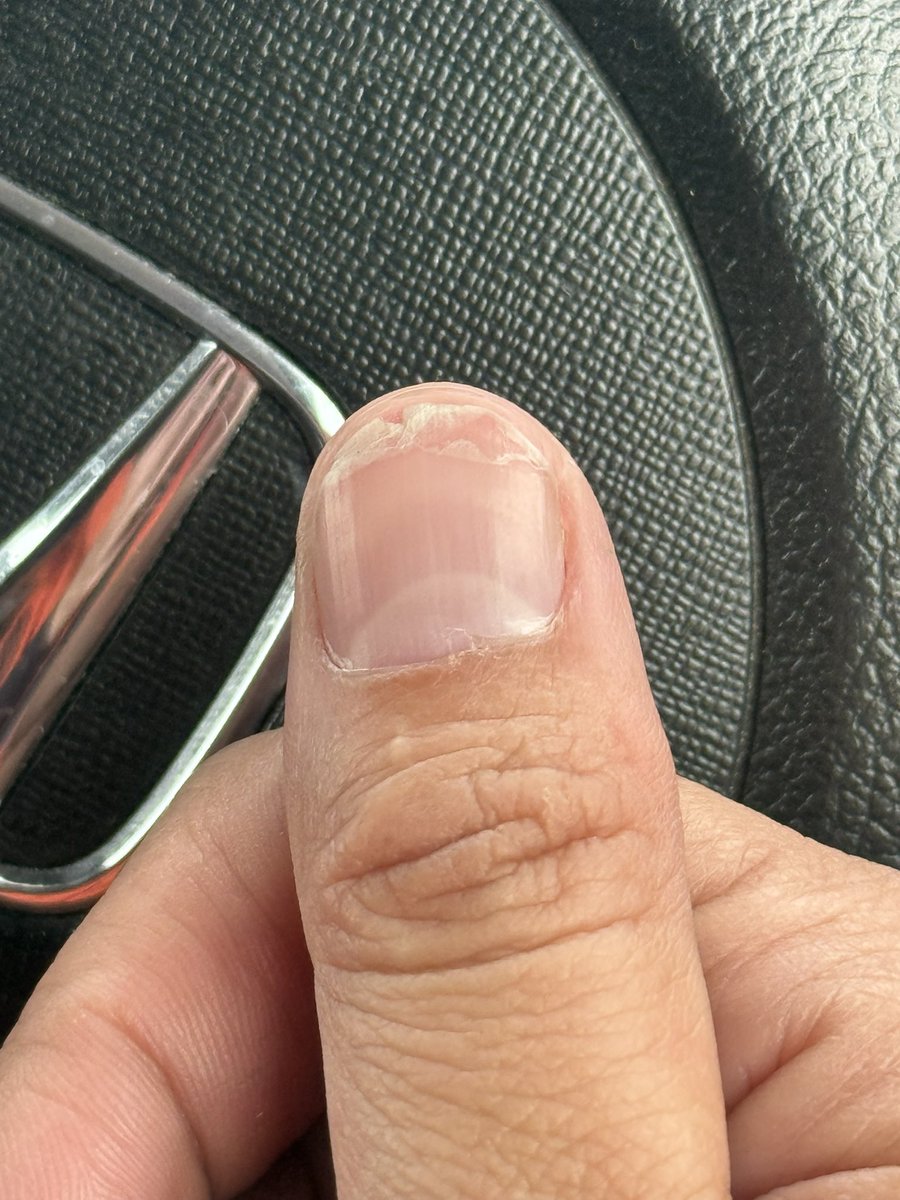 たはらかすみ☆ZX10R☆ZX25R☆NSF100 (@kasumithr) / Posts / X