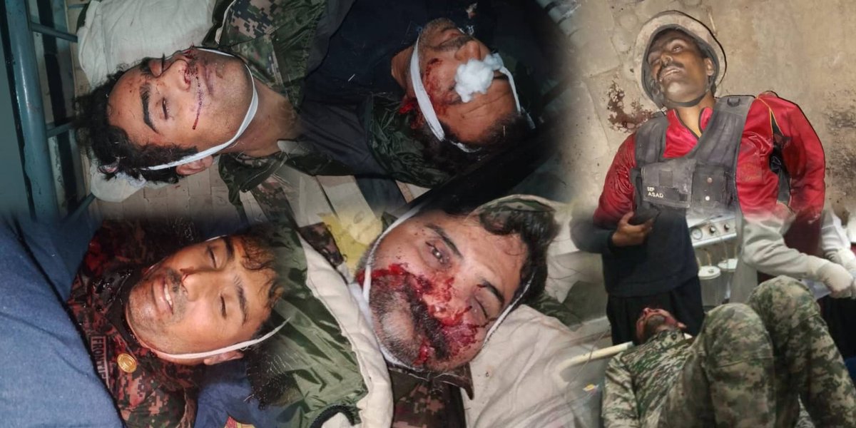 کمزوری او بزدل دښمن تل زموږ ملکي وګړي په نښه کړي، خو موږ به دا ځل هم د تېر په څېر د دوی پوځیان، که له پتلون سره وي یا هم بې پتلونه، داسی به یې سینګار کړو چې خلک به له خوشحالی ورته ژاړي.
دا یی د هغه تیر ځل کباړ ده !