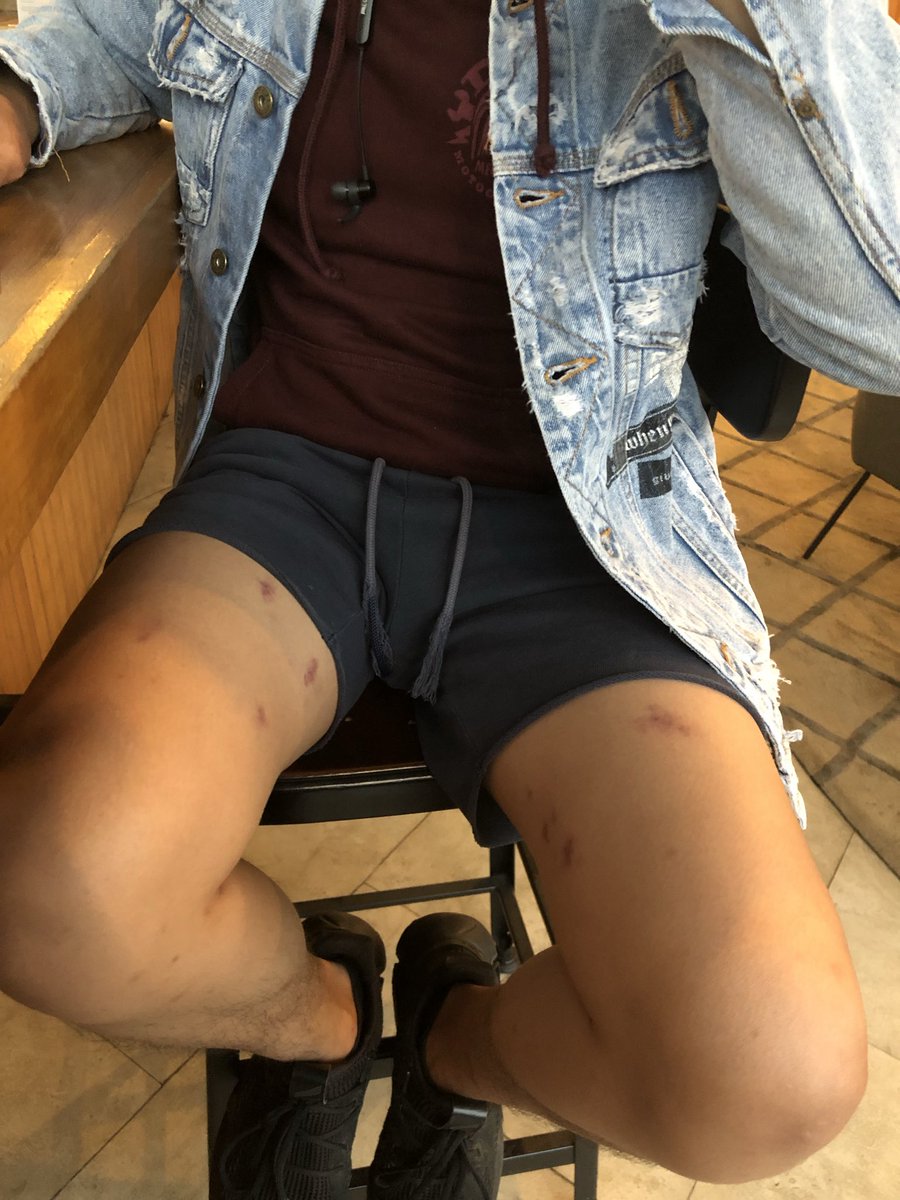 WilliamBowery5's tweet image. Hasil:
Semaleman dicupangin seluruh badan, 

then my ex said “Sayang nanti wfc nya pake celana pandek aja ya”