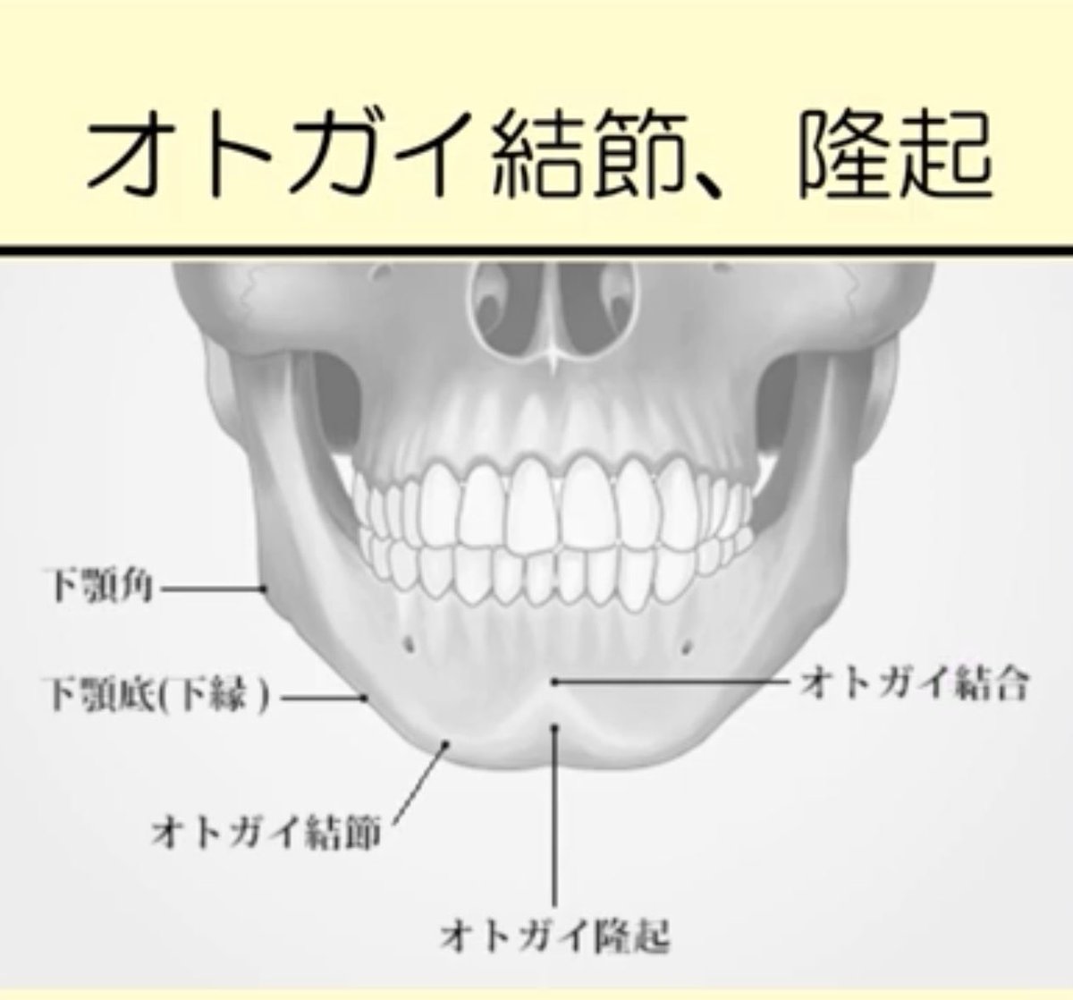歯科医師国家試験対策 ロムニーハウス勉強会【講師 Dr.N