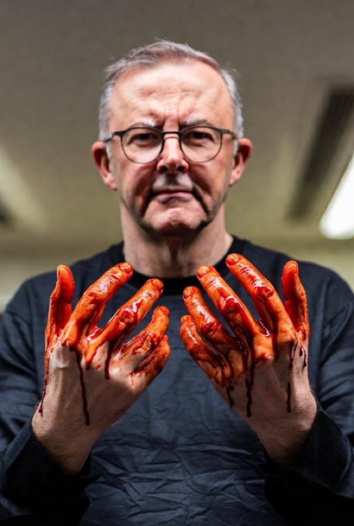 He joined Hamas' propaganda campaign to demonize us. His foreign minister echoed all Hamas lies in official statements as “facts.”

The Australian government is an ally of Hamas!

Wake up, Australia! Vote him out.
He paid for his Muslim votes with Jewish blood!

Don’t let him win