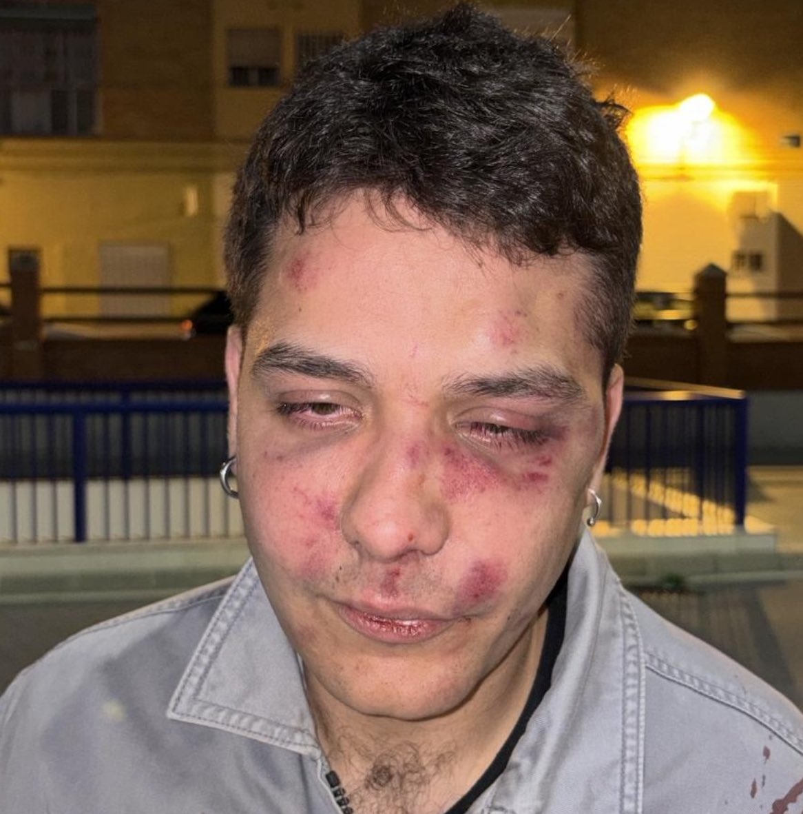 En la pasada noche del viernes un grupo de jóvenes le pegaron una paliza grupal a mi amigo romero en Málaga, al grito de maricón.

Justo en la salida de la discoteca (Bro)
Los agresores vestían con camisa y llevaban pulseras de Vox.

Intentamos encontrarlos.
¿Nos difundes?