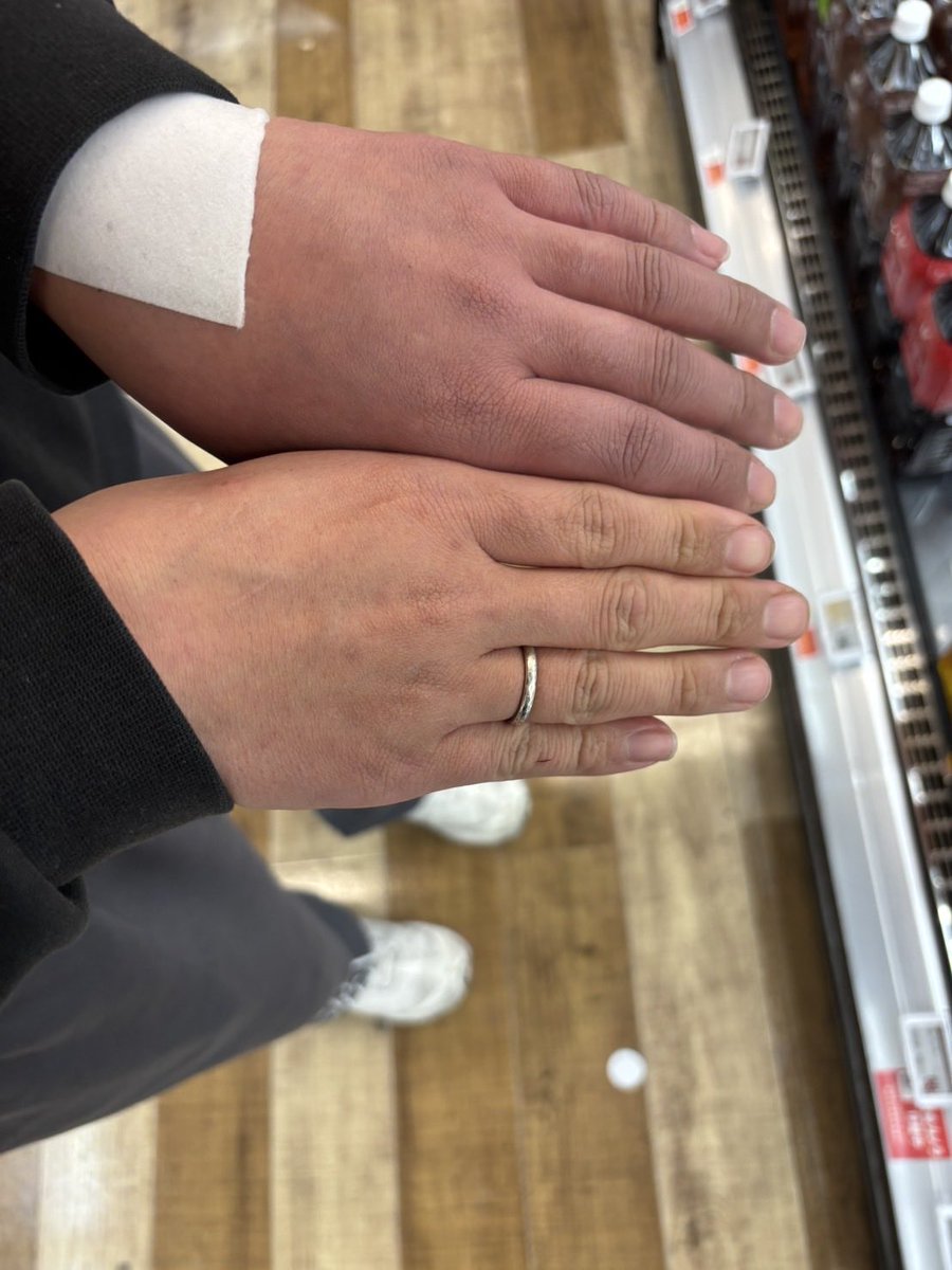 え、ヤバくない？
左手ゾンビ？？