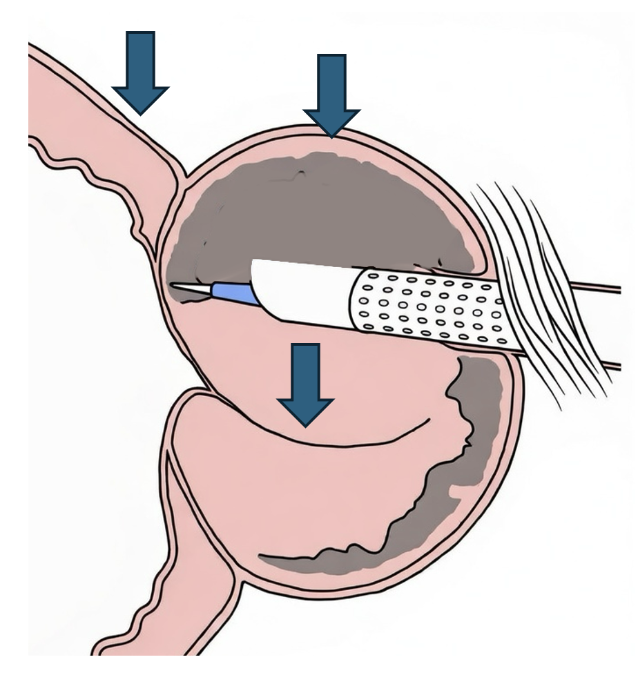Fernando GomezSancha tweet media