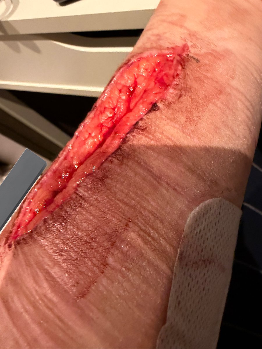 Minesweeper of shtwt tweet media