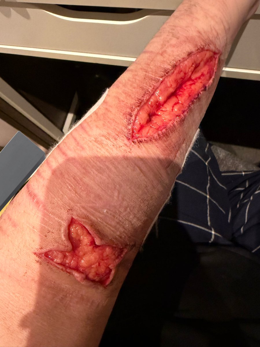 Minesweeper of shtwt tweet media