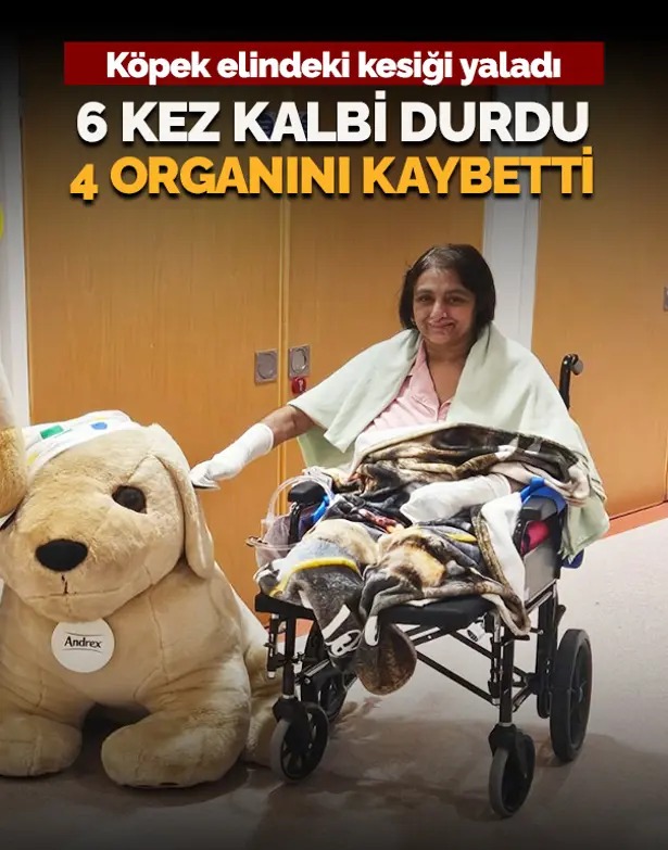 KÖPEĞİN YALADIĞI YARA FELAKETE YOL AÇTI
6 kez kalbi duran genç kadın 2 elini ve 2 bacağını kaybetti

ntv.com.tr/galeri/dunya/e…

Foto: NTV
