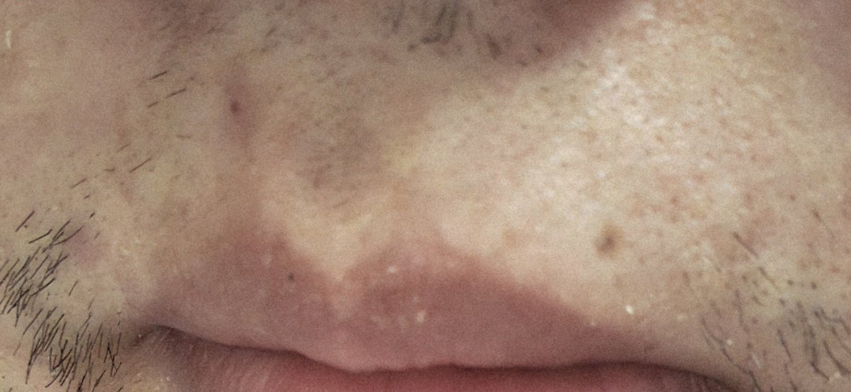 小蘑菇头🍄 tweet media