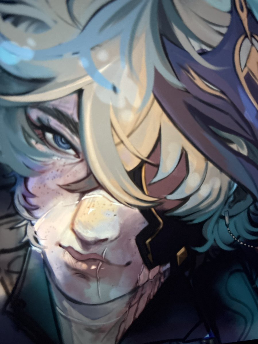 CURRENTLY WORKING ON HIM.