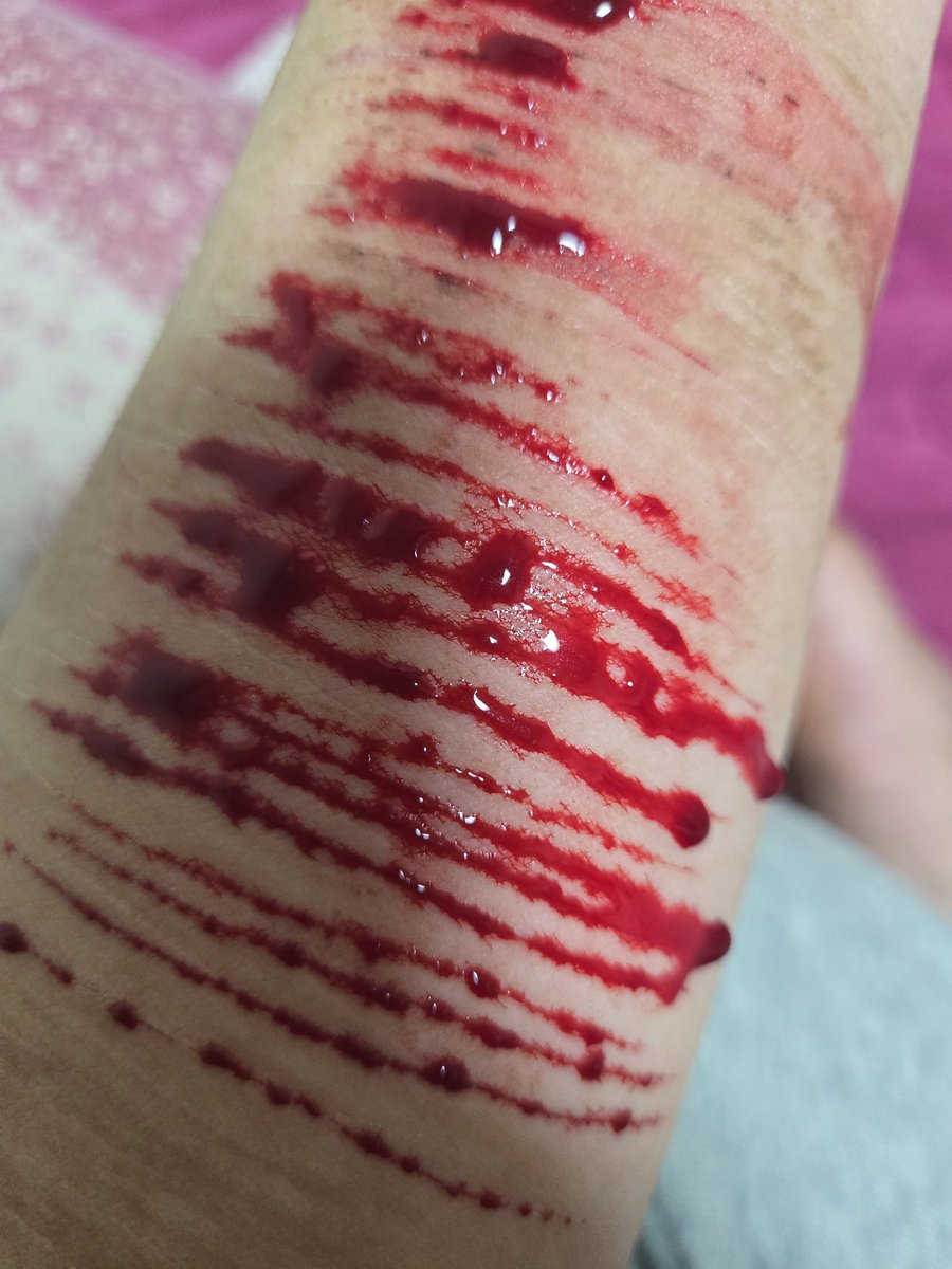_byeongirl's tweet photo. 오렌만에..😍 아는 동생이랑 얘기하다가 자해했어요 #자해 #selfharm https://t.co/Wv5MVxm6am
