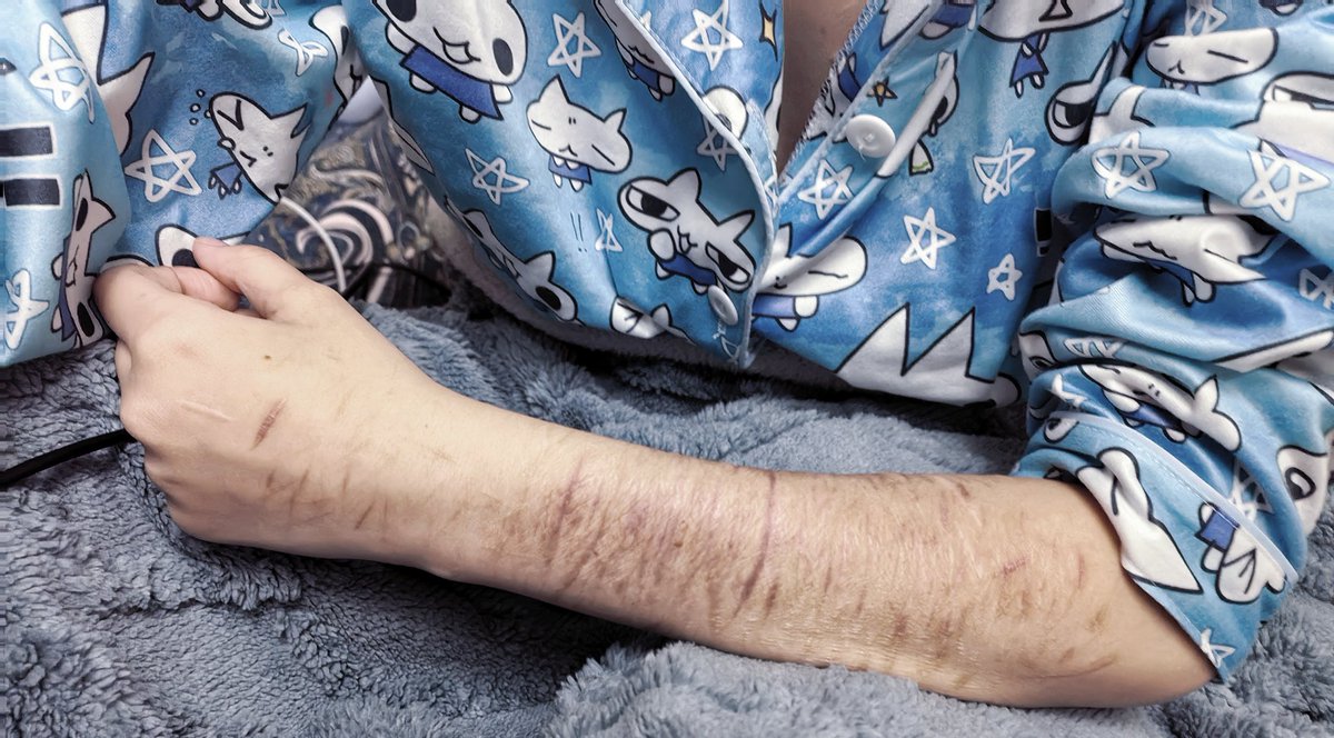 Туман tweet media