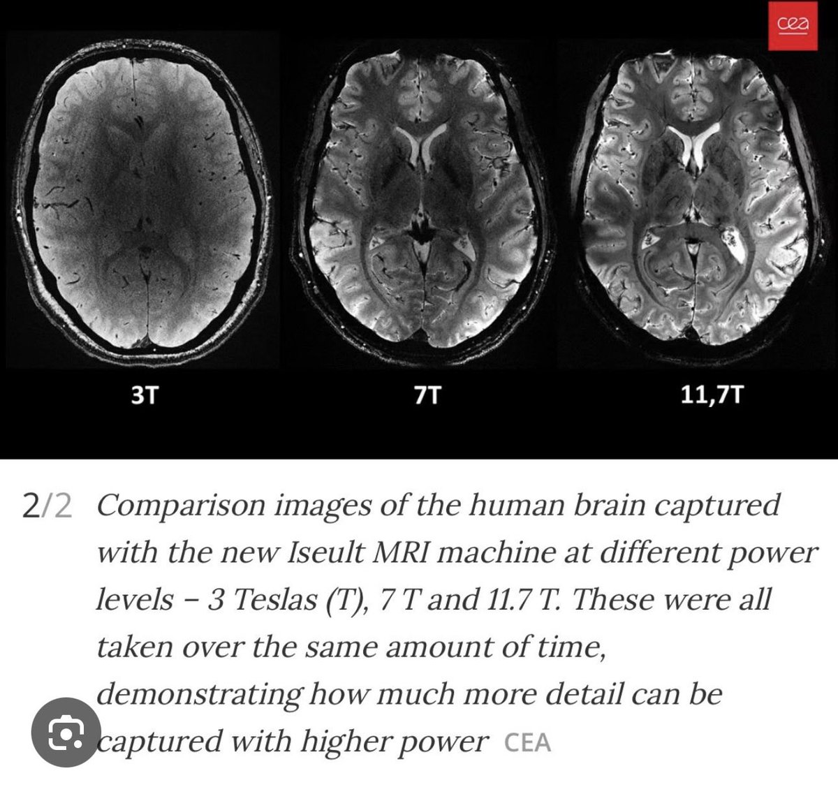 Plain language: Only a 7-Tesla MRI ( not the 1.5 or 3.0 Tesla one most patients get scans on) shows that both #LongCovid and #MECFS patients had large hippocampi ( part of the brain) . It maybe “in your head” but your doctor can’t see it because she does have access to sharp