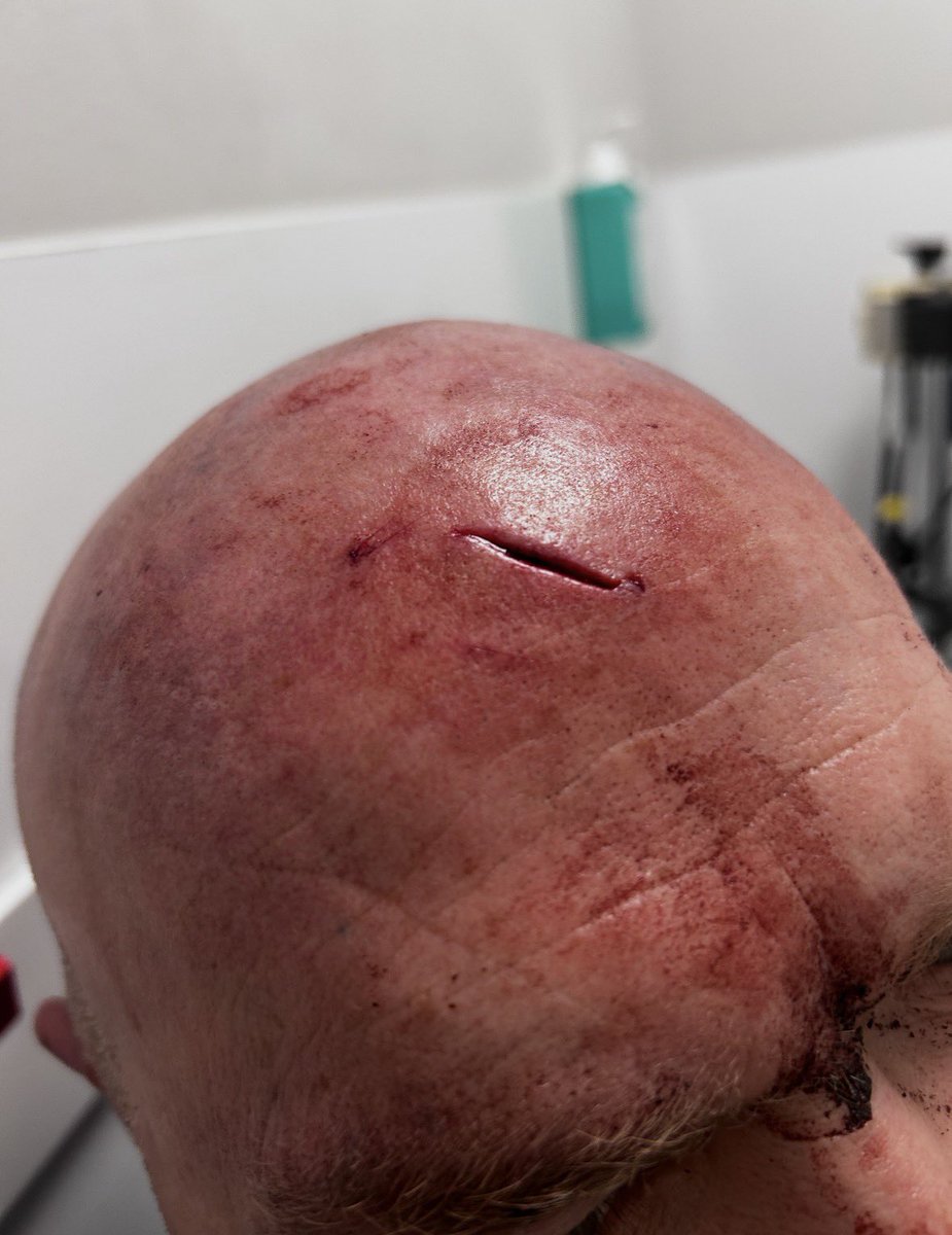 Lakefest Daff tweet media