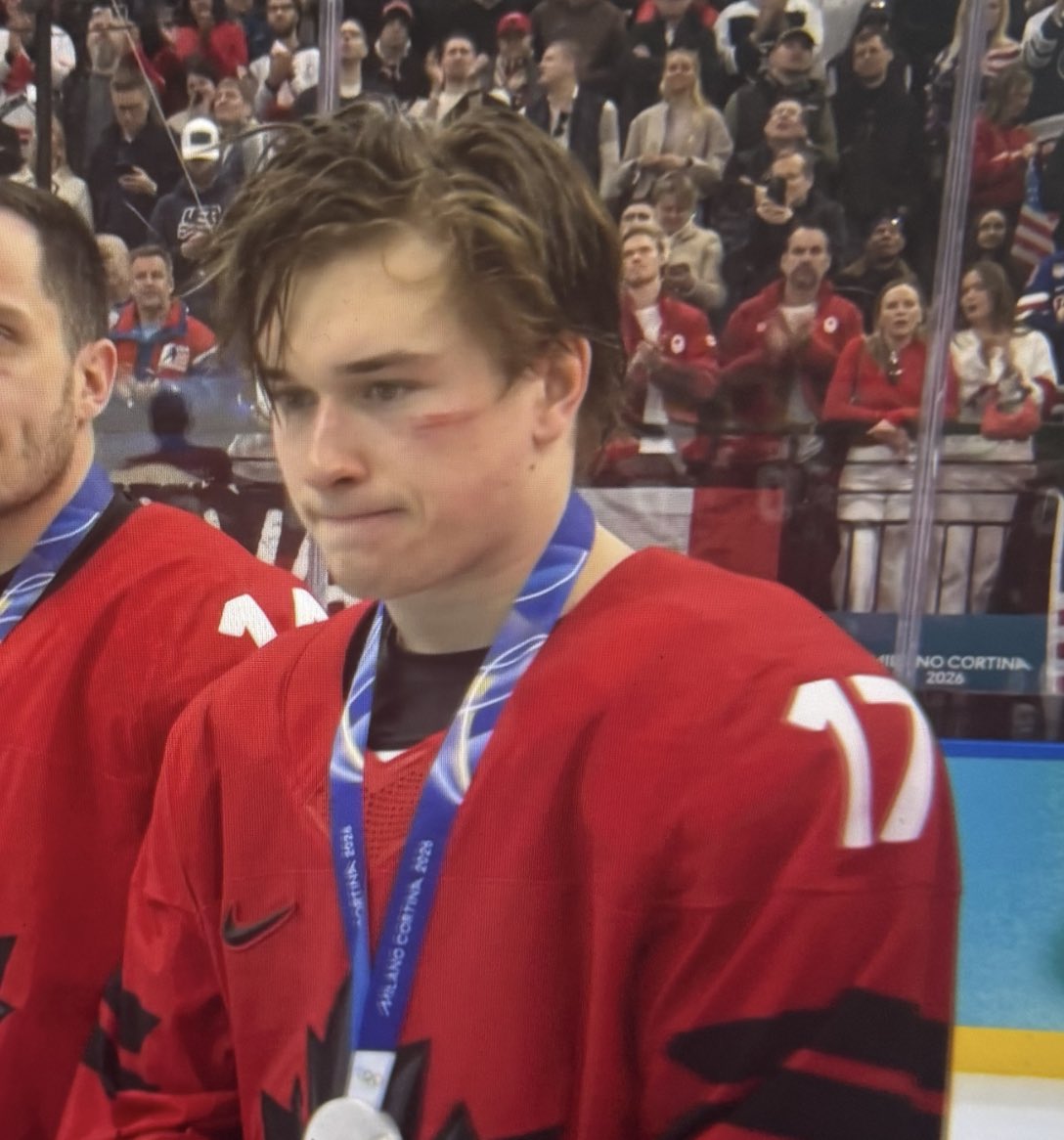 remy ✰ tweet media