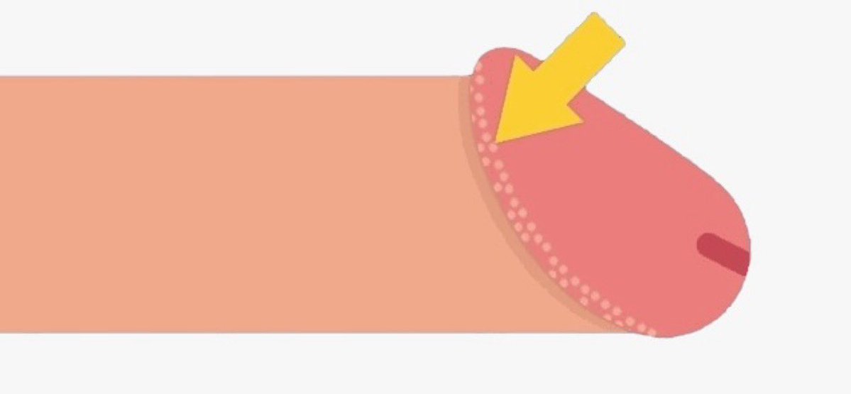 HORA DA BIOLOGIA CARALHO!!

Você ja deve ter se perguntado o que caralhos são essas bolinhas debaixo da cabeça do pau, afinal, é uma doença venérea, algo normal, um choquito de piroca?pode ficar calmo que não é IST (até pq tu não transa), senta ai que eu explico